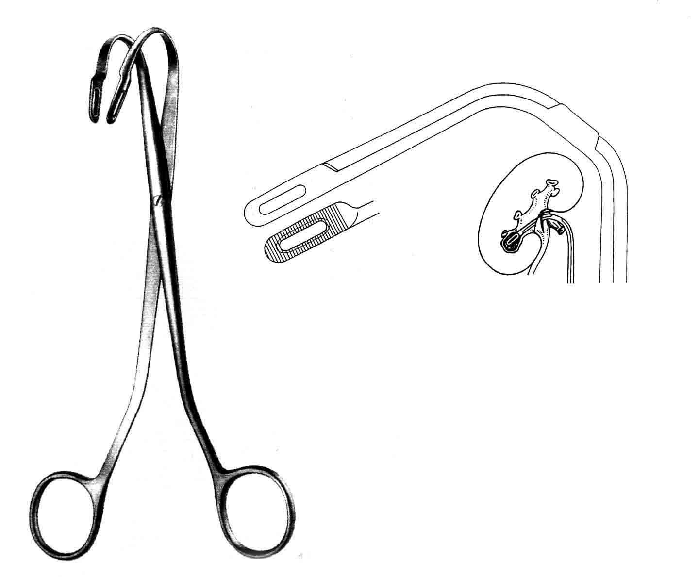 RANDAL TAŞ KLEMPİ 19CM